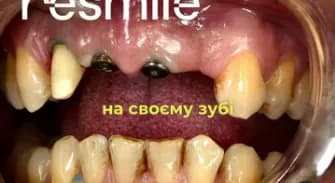 video preview Кейси